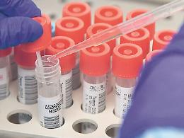 Coronavirus in Sicilia, 198 nuovi casi
Ecco il bollettino del 6 ottobre