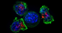 Arriva in Italia Car-T, il farmaco che ferma i tumori del sangue