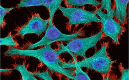 Trovati i percorsi nascosti che portano ai tumori: ecco la prima mappa delle mutazioni